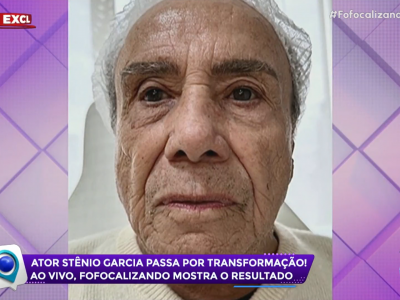 Stenio Garcia harmonização facial